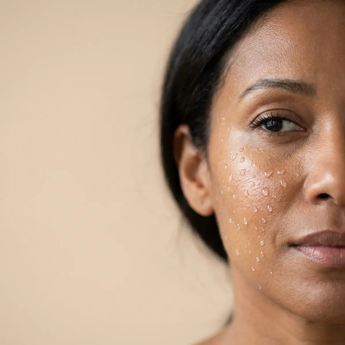 Analizamos el estrés mineral detrás de los brotes de melasma