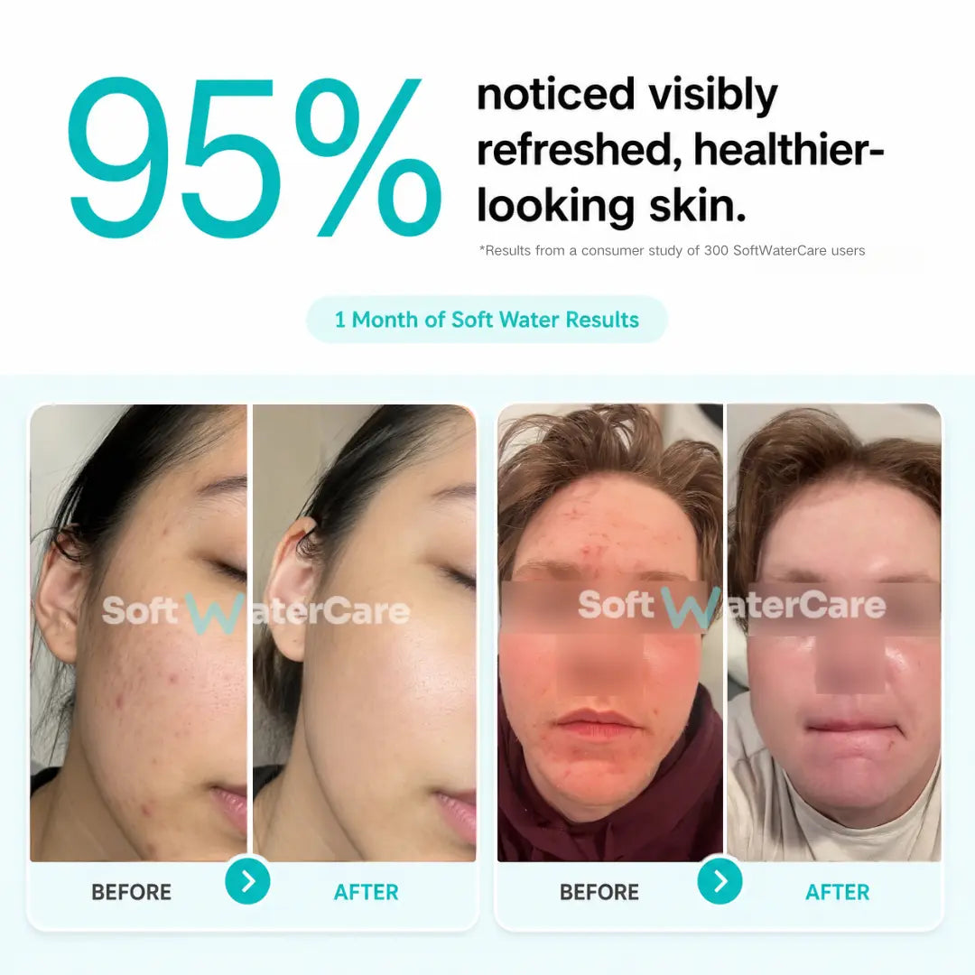 Shower Water Softener System